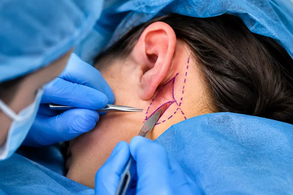 Mastoid Surgery